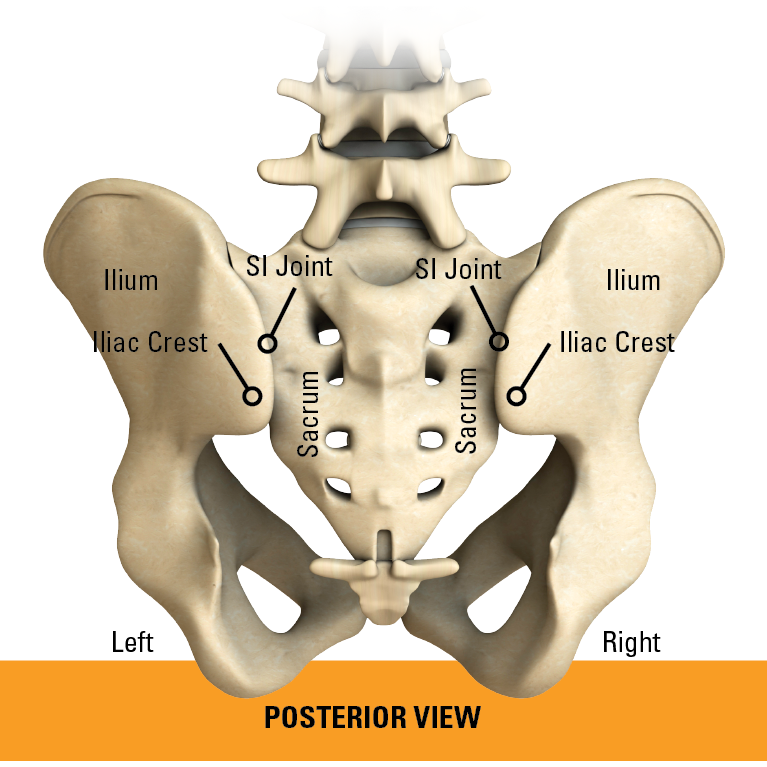 transfasten posterior si fusion system pelvis posterior view labeled